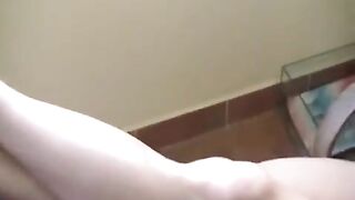 A naked girl with big natural tits got burned